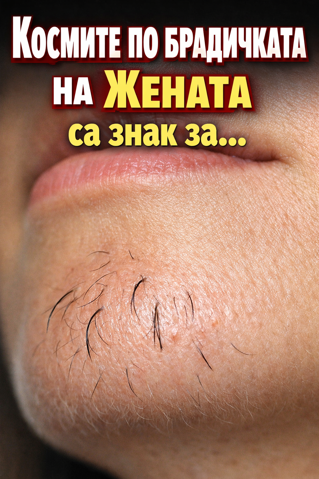 Космите по брадичката на жената са знак за... 1 8c51dcf5 39ae 4b5c ba05 2fa5ac2e56c7