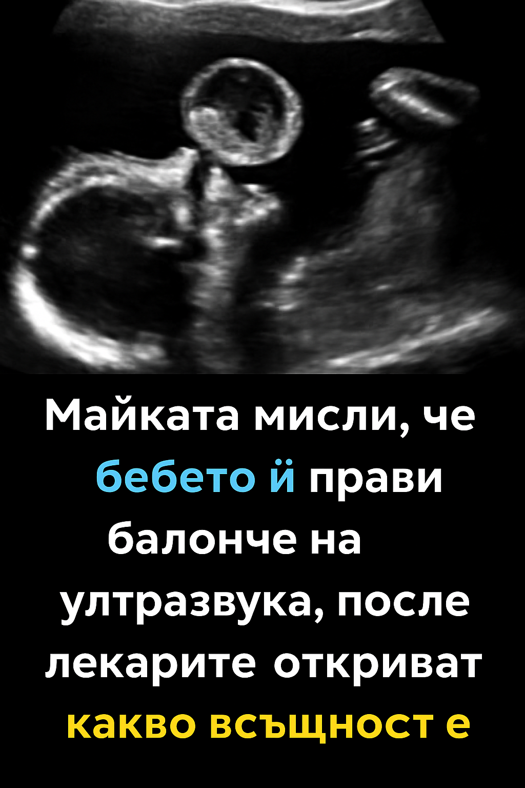 Майката мисли, че бебето ѝ прави балонче на ултразвука, после лекарите откриват какво всъщност е. 1 0f3d864d 8cc7 45ce 8008 f55e7e975c45