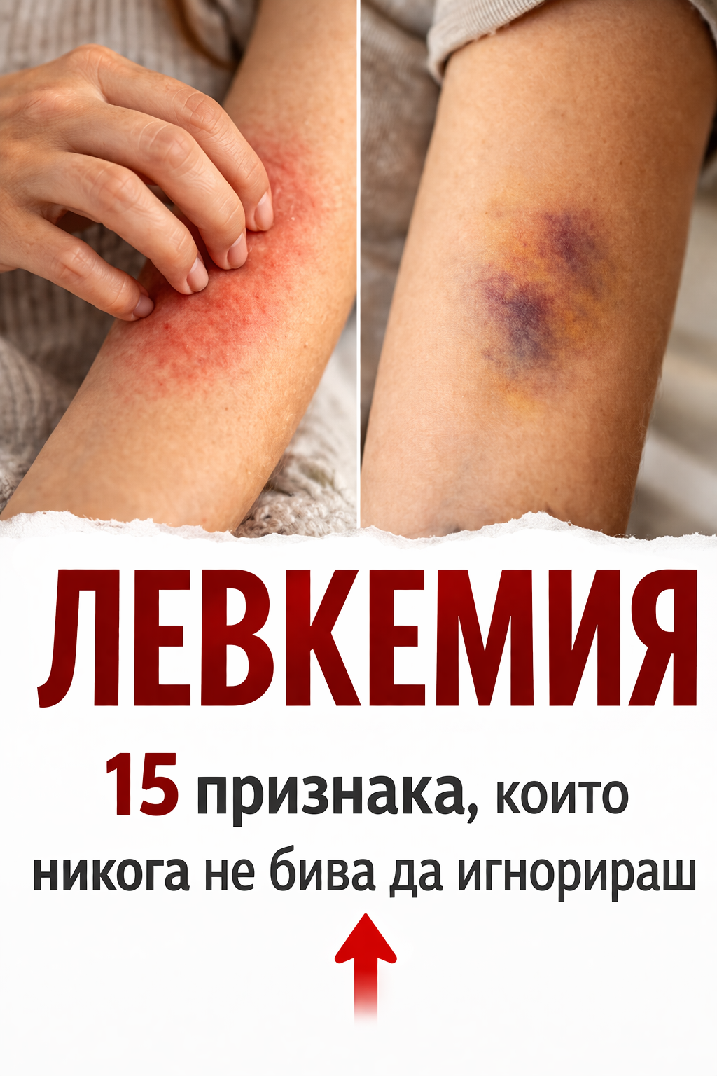 15 признака, които могат да означават, че имате левкемия и които никога не бива да се игнорират. 1 67a14d9d bd0a 4dbf 8f21 48c86cc47262