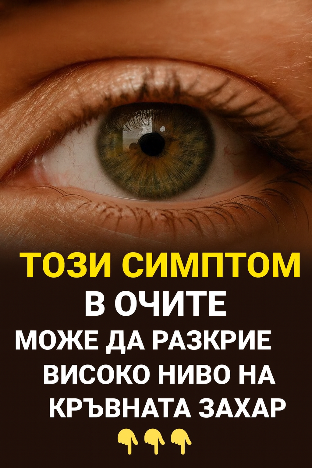 ТОЗИ СИМПТОМ В ОЧИТЕ МОЖЕ ДА РАЗКРИЕ ВИСОКО НИВО НА КРЪВНАТА ЗАХАР 👇👇👇 1 0f0495e7 e565 436b a335 53da08e2854d