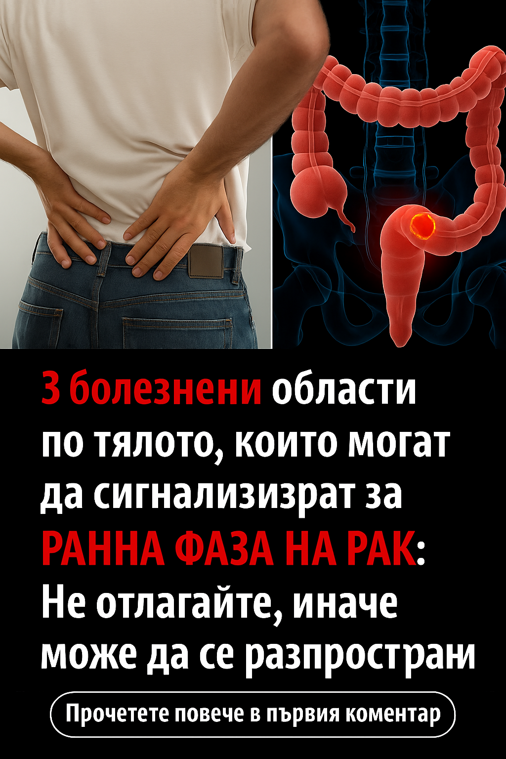 3 болезнени области по тялото, които могат да сигнализират за ранна фаза на рак: Не отлагайте, иначе може да се разпространи 1 b839f8cc 170d 4f44 9e34 92a39332c665