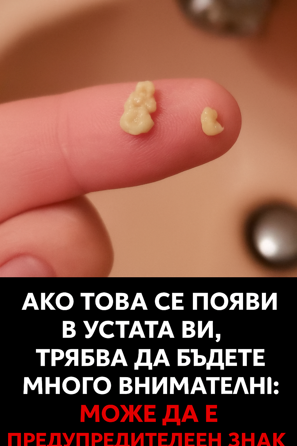Виждаш ли това в устата си? Не го пренебрегвай – може да сигнализира за ... 1 aae92bac add4 452e 89d2 7d332d9e8a4f