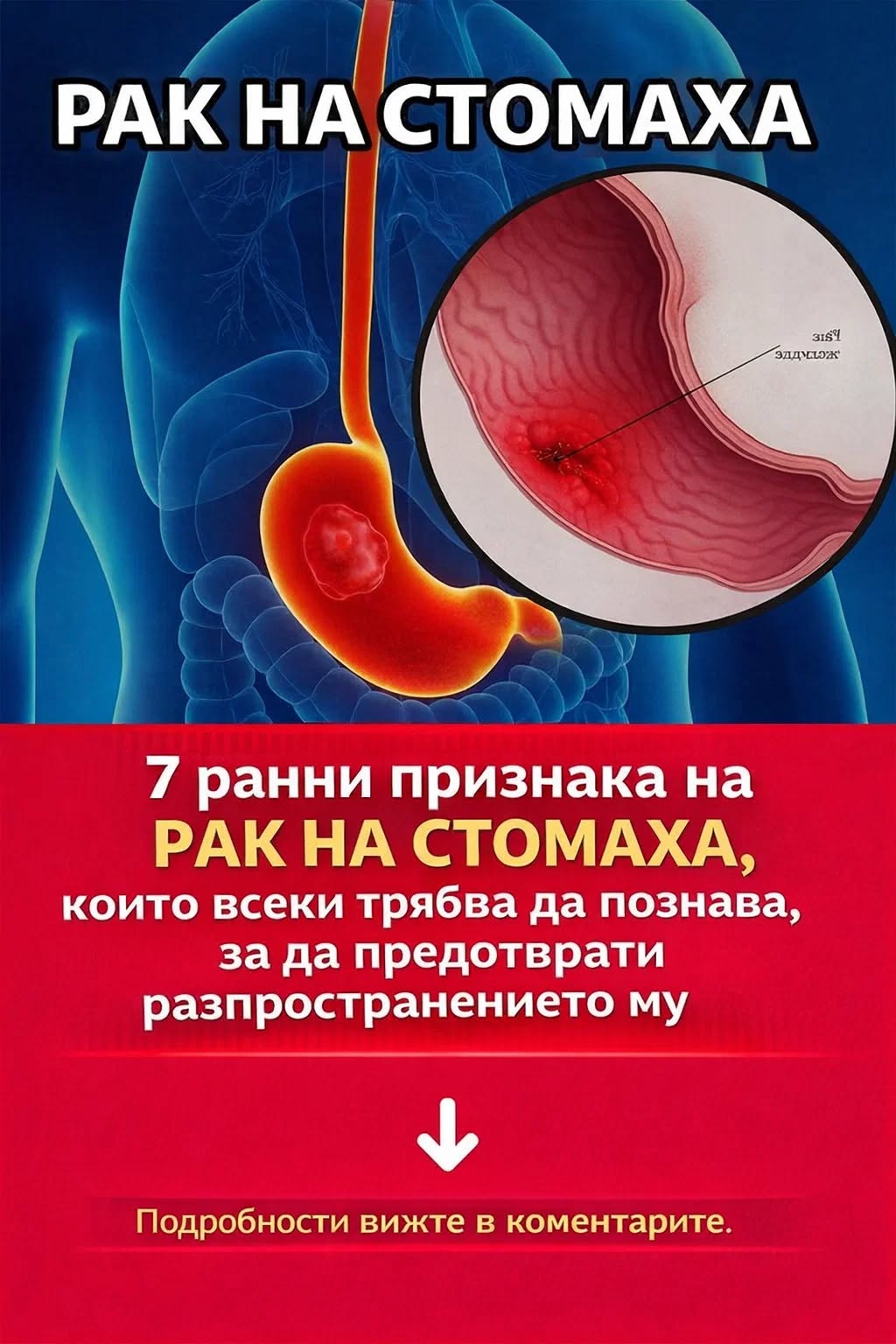 7 ранни признака на рак на стомаха, които всеки трябва да познава, за да предотврати разпространението му 1 616660877 1456459859823565 1967004488706542936 n