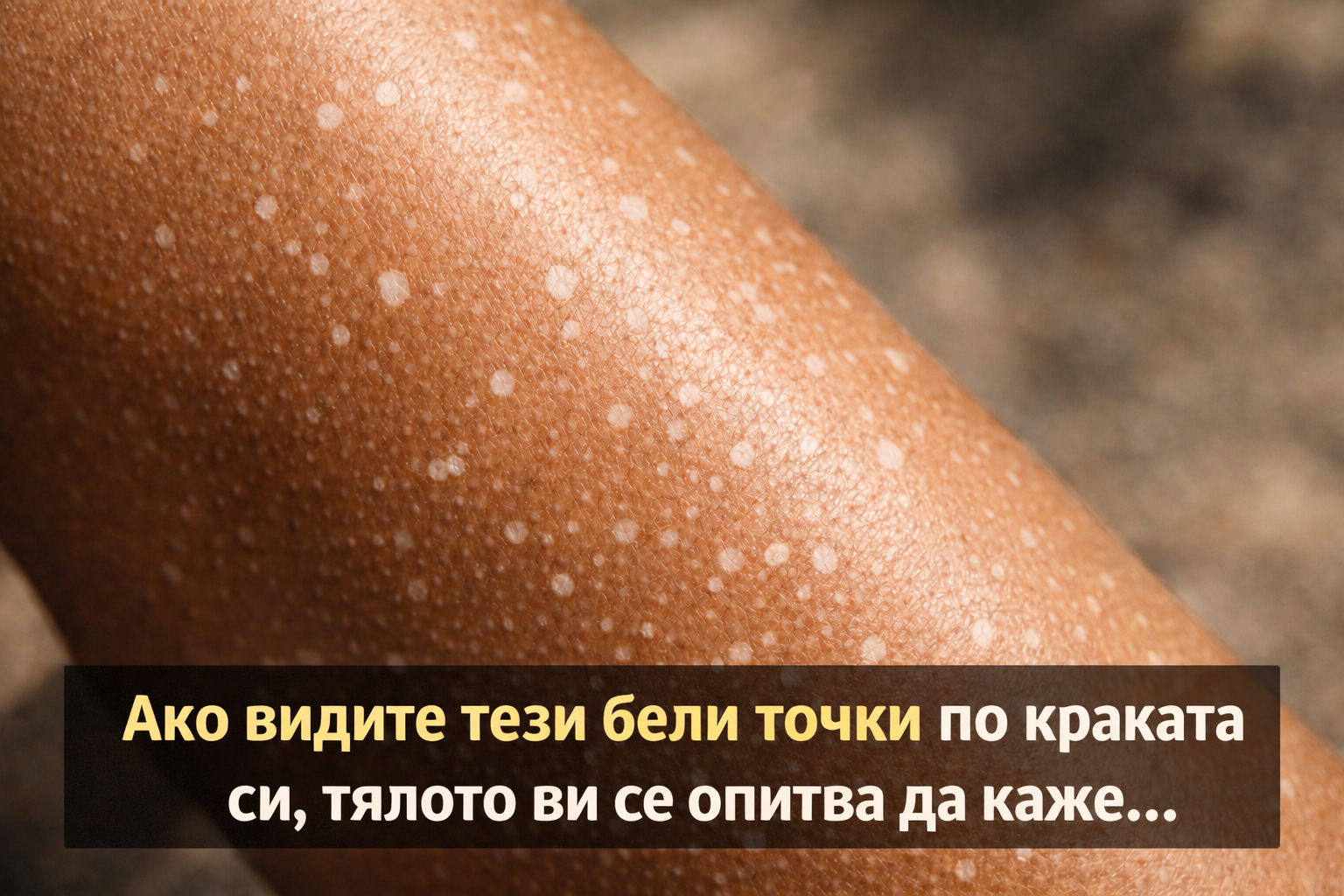 Ако видите тези бели точки по краката си, тялото ви се опитва да каже... 1 16f96298 8bcf 4c22 ae44 a5e79511f899